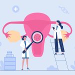 Dépistage du HPV : des serviettes hygiéniques à la place d&rsquo;un frottis ?