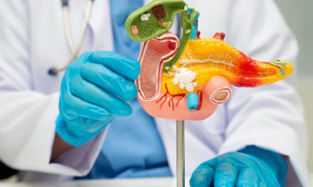 Cancer du pancréas : découverte d’une nouvelle famille de cellules immunitaires chez les « super-répondeurs »