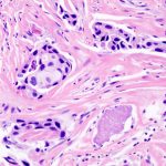 Oncologie : Waiv obtient le marquage CE-IVDR de deux tests de précision 