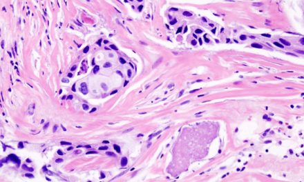 Oncologie : Waiv obtient le marquage CE-IVDR de deux tests de précision 