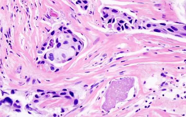 Oncologie : Waiv obtient le marquage CE-IVDR de deux tests de précision 